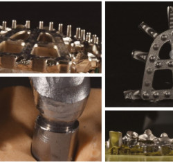 Ceramill Sintron - La rivoluzione digitale del metallo