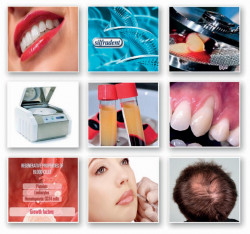 Concentrato di fattori di crescita  (Concentrated Growth Factors – CGF)
