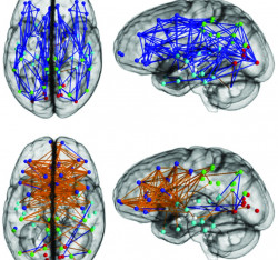 Come le neuroscienze hanno  rivoluzionato il marketing 