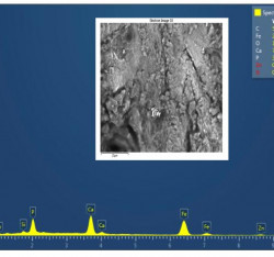 Analisi della deposizione di particelle metalliche dalle frese chirurgiche dopo procedure di chirurgia implantare guidata