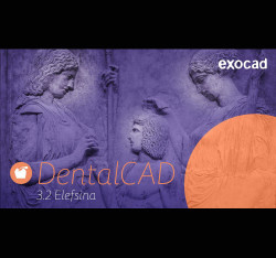 exocad presenta il Software Dentalcad 3.2 Elefsina con oltre 60 Funzioni per una Maggiore Automazione e Velocità