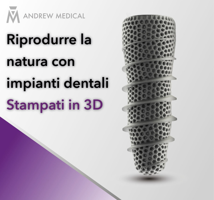 Riprodurre la natura con impianti dentali stampati in 3D