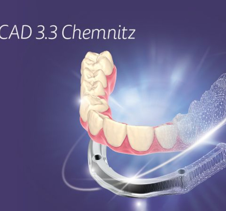 Il nuovo PartialCAD 3.3 Chemnitz di exocad introduce un flusso di lavoro per Split Denture